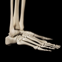 What are Stress Fractures?