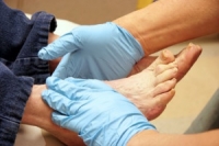 The Importance of Diabetic Foot Care