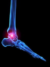 The Immune System and Rheumatoid Arthritis